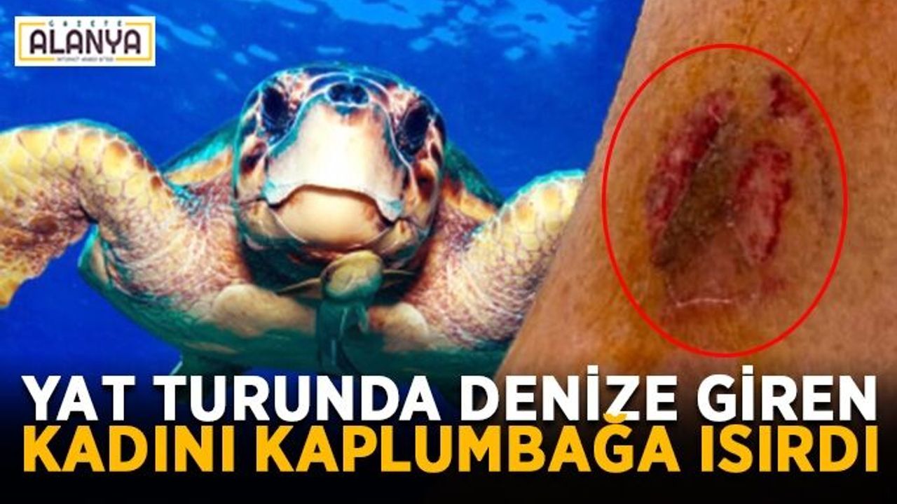 Denize giren kadının bacağını kaplumbağa ısırdı