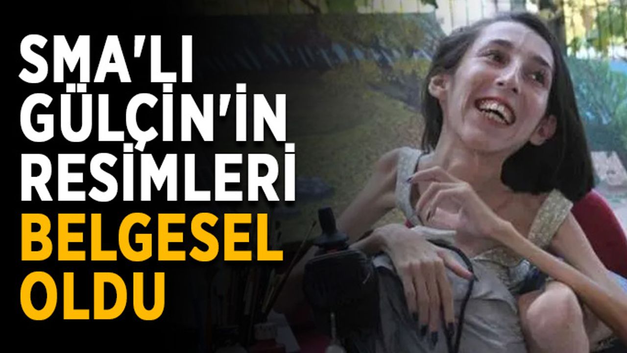 SMA'lı Gülçin'in çizdiği resimler belgesel oldu