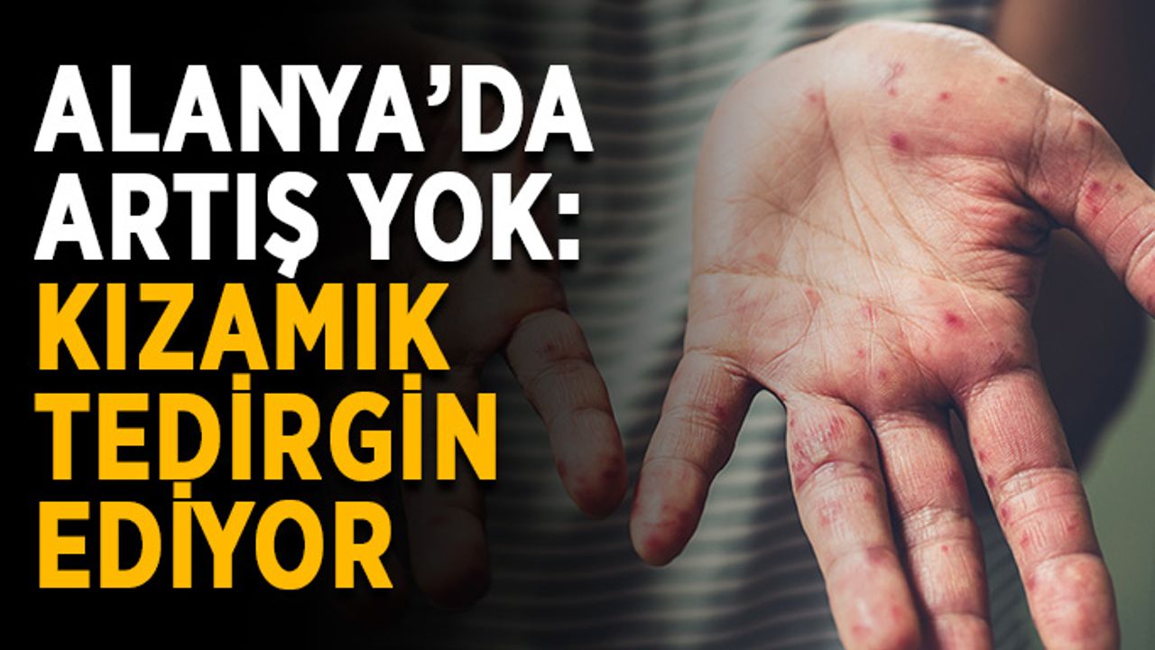 Alanya’da artış yok: Kızamık tedirgin ediyor