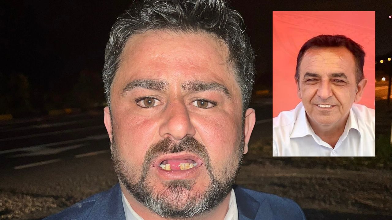 MHP İlçe Başkanı Sünbül’e hiç yakışmadı! Adam dövdü, dişlerini kırdı