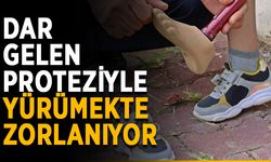 Dar gelen proteziyle yürümekte zorlanıyor