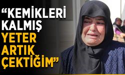 “Kemikleri kalmış, yeter artık çektiğim”