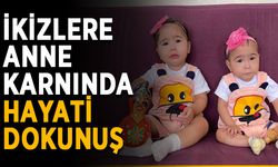 İkizlere anne karnında hayati dokunuş