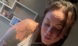 Kanadalı turist, estetik sonrası can verdi