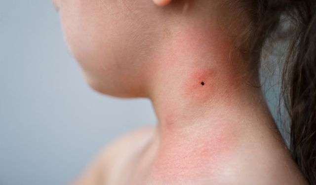 Alanya'da başımıza bir de bu çıktı: Lyme hastalığı riski artıyor